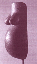 Hypnose en anesthésie obstétricale, Hypnose et accouchement Hypnose en anesthésie obstétricale, Hypnose et accouchement