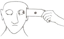 Traitement d’un cas de trouble obsessionnel par l’utilisation d’images spontanées Traitement d’un cas de trouble obsessionnel par l’utilisation d’images spontanées