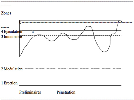 Traitement sexofonctionnel de l’éjaculation prématurée. Accéder à une vie sexuelle épanouissante