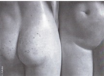 Le vaginisme ou le langage du corps. Laure Mourichon pour Revue Sexualites Humaines 12 Le vaginisme ou le langage du corps. Laure Mourichon pour Revue Sexualites Humaines 12