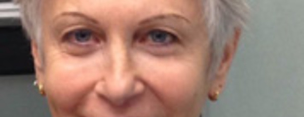 Hypnose, douleurs et diabète, neuropathies…Dr Francine HIRSZOWSKI